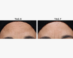 Age Spot Cream Serum - 30ml