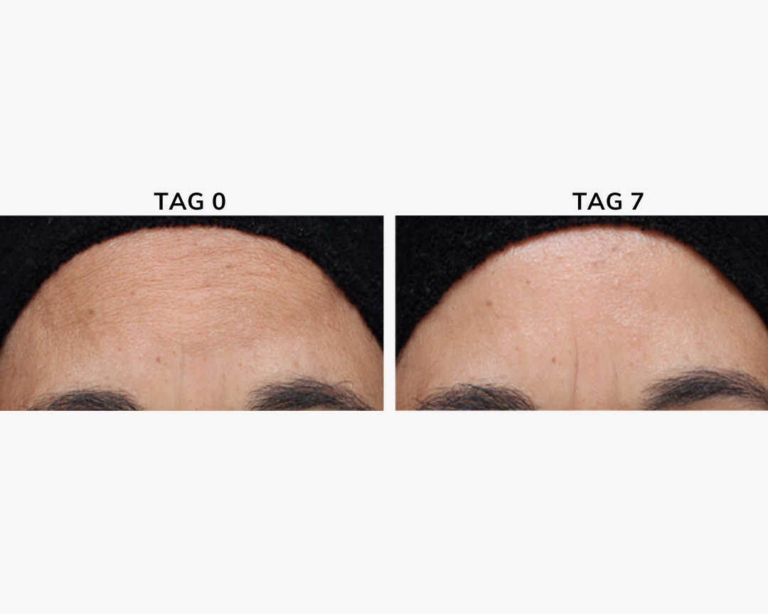 Age Spot Cream Serum - 30ml