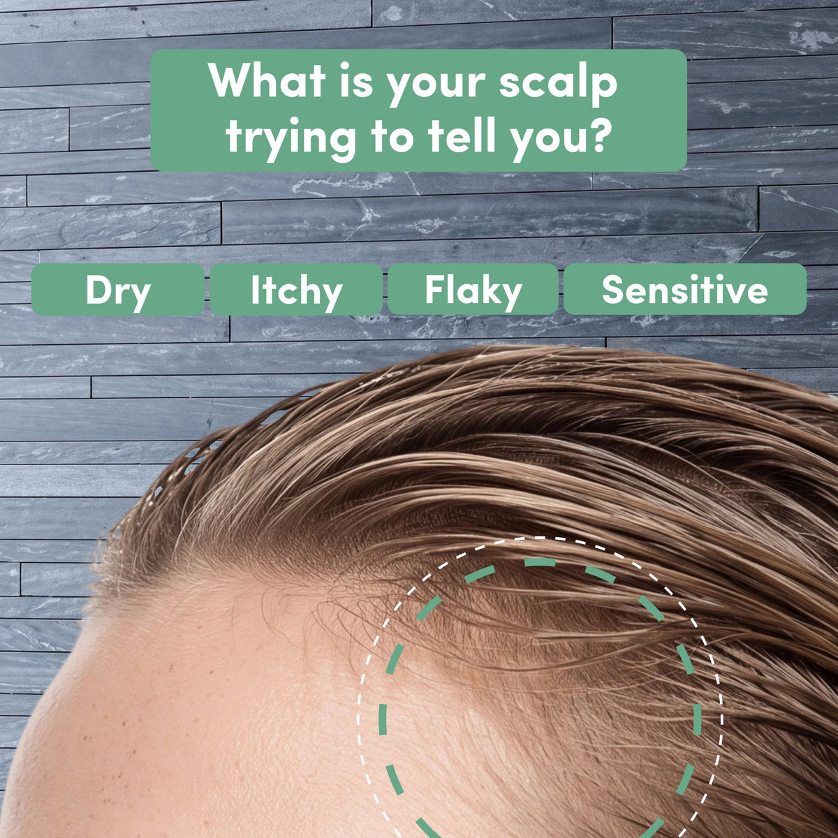 Soothing Scalp Lotion 150 ml